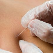 Island Acupuncture &amp; Massage photo