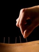 Island Acupuncture &amp; Massage photo